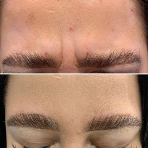 ANTI WRINKLE TREATMENTS AT MAKEOVER PALACE HAIR & BEAUTY SALON IN KIDLINGTON, OXFORD