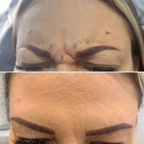 Makeover Palace Anti Wrinkle Treatments 3 ANTI WRINKLE TREATMENTS AT MAKEOVER PALACE HAIR & BEAUTY SALON IN KIDLINGTON, OXFORD