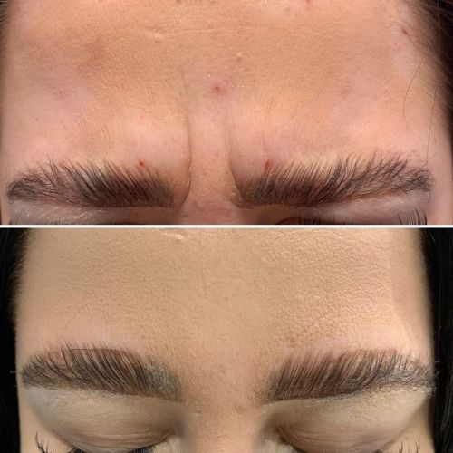 Makeover Palace Anti Wrinkle Treatments ANTI WRINKLE TREATMENTS AT MAKEOVER PALACE HAIR & BEAUTY SALON IN KIDLINGTON, OXFORD