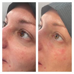 Makeover Palace Anti Wrinkle Treatments 1