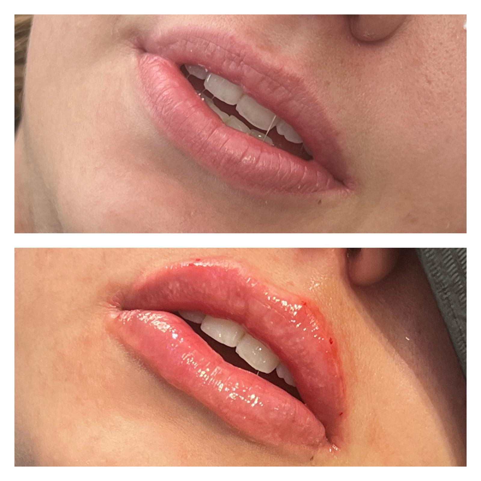 7 1 ANTI WRINKLE TREATMENTS AT MAKEOVER PALACE HAIR & BEAUTY SALON IN KIDLINGTON, OXFORD