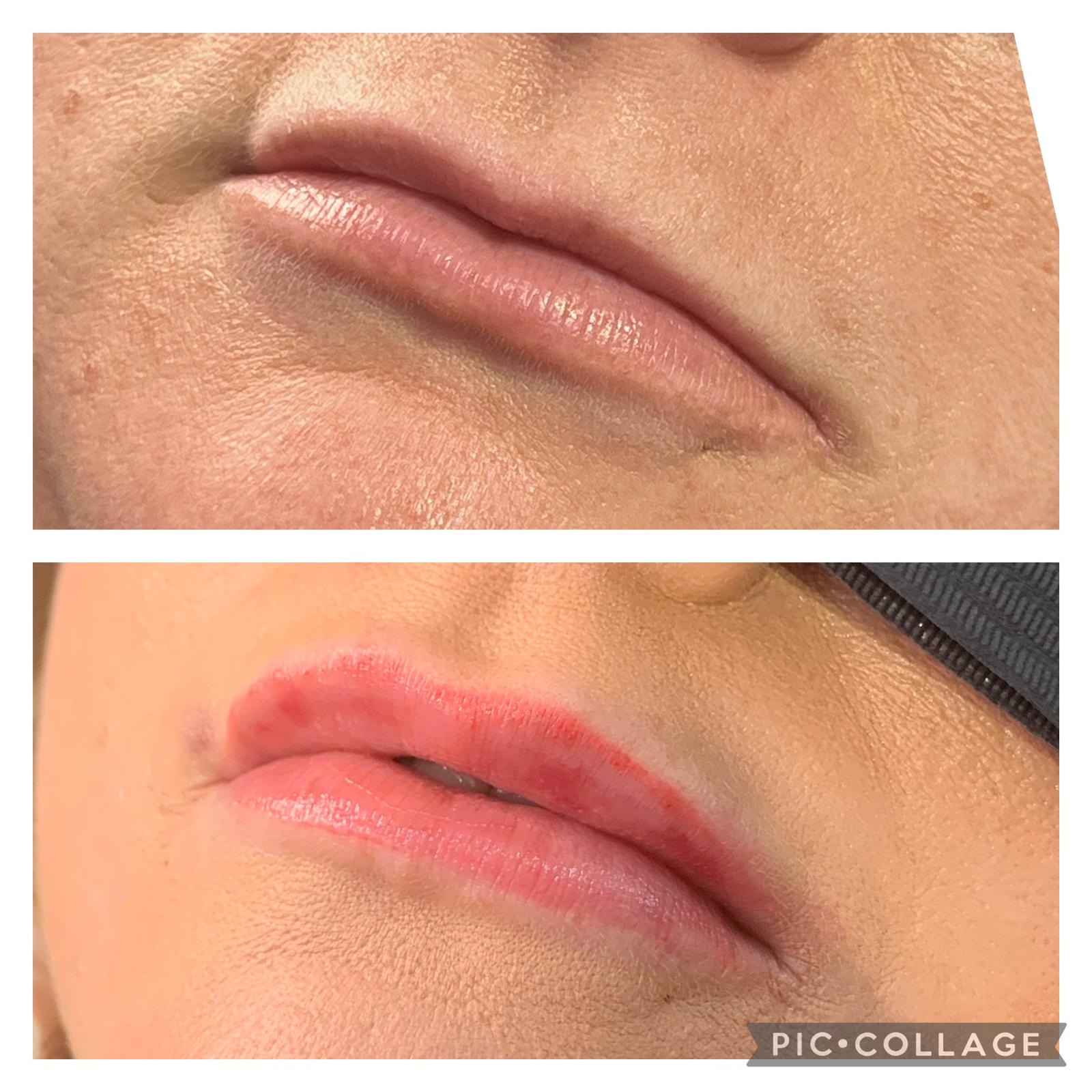 8 1 ANTI WRINKLE TREATMENTS AT MAKEOVER PALACE HAIR & BEAUTY SALON IN KIDLINGTON, OXFORD