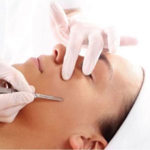 Dermaplaning Treatment 