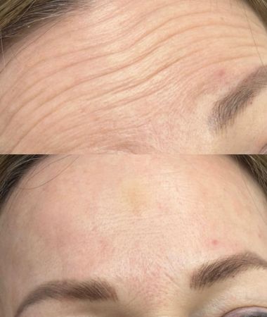 Aesthetics Clinic Near Me