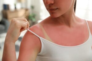 Safe tanning advice